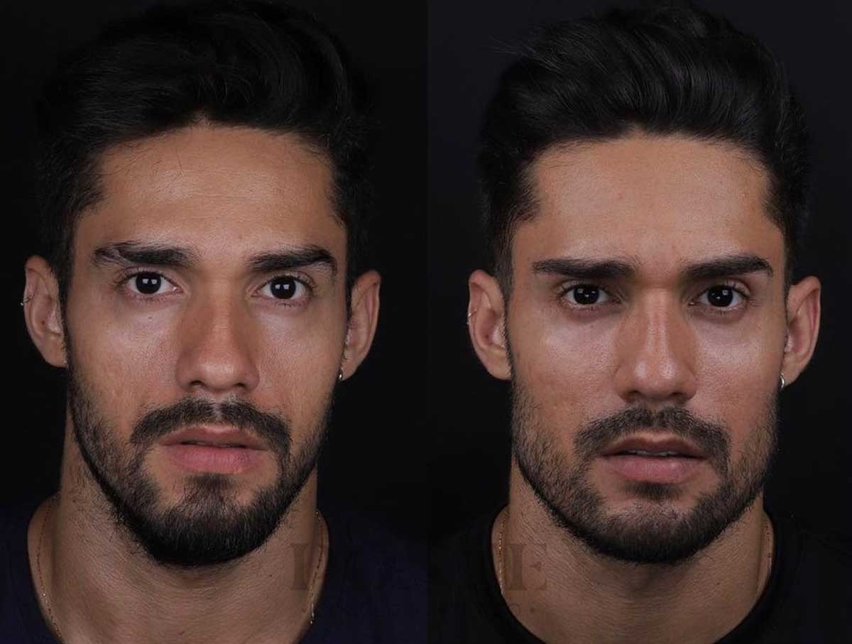 Mandíbula quadrada é tendência nos Brothers do BBB21 - imagem 2