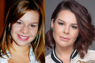 Você sabe o que Fernanda Souza e Bela Fernandes tem em comum? As duas atrizes fizeram rinoplastia ainda na - imagem 2