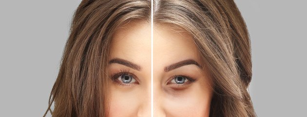 Você Sabia Que A Primeira Área Que Envelhece São As Dos Olhos?