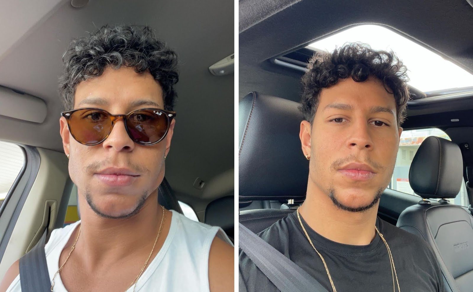 Exagero ou inchaço? Por que as selfies de famosos pós-harmonização facial sempre causam polêmica? - imagem 2