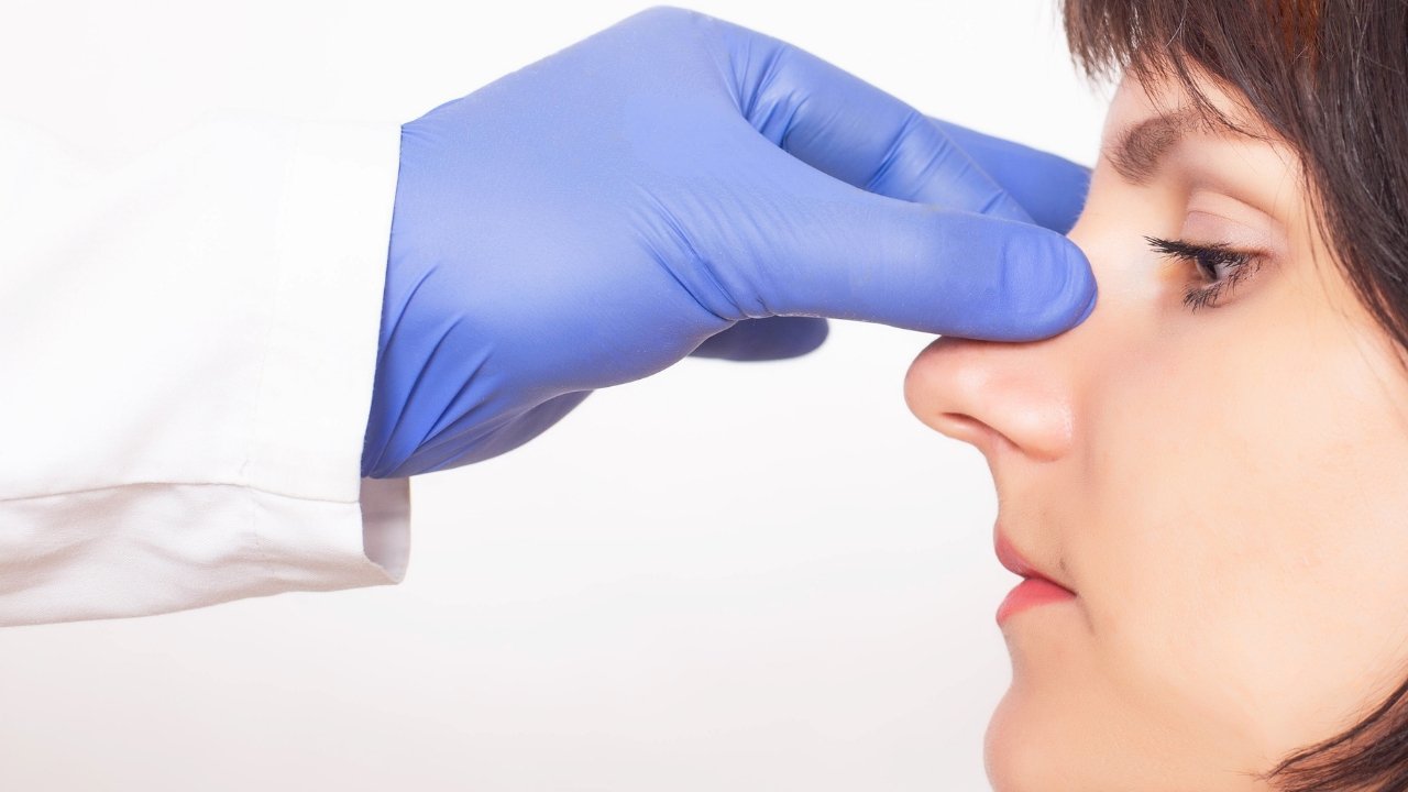 O Que a Rinoplastia Pode Fazer Por você?