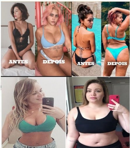 Antes e depois' invertido: verão 2022 registra aumento de pessoas compartilhando o ganho de peso nas redes