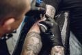 Remoção de tatuagem: Vale mesmo a pena?