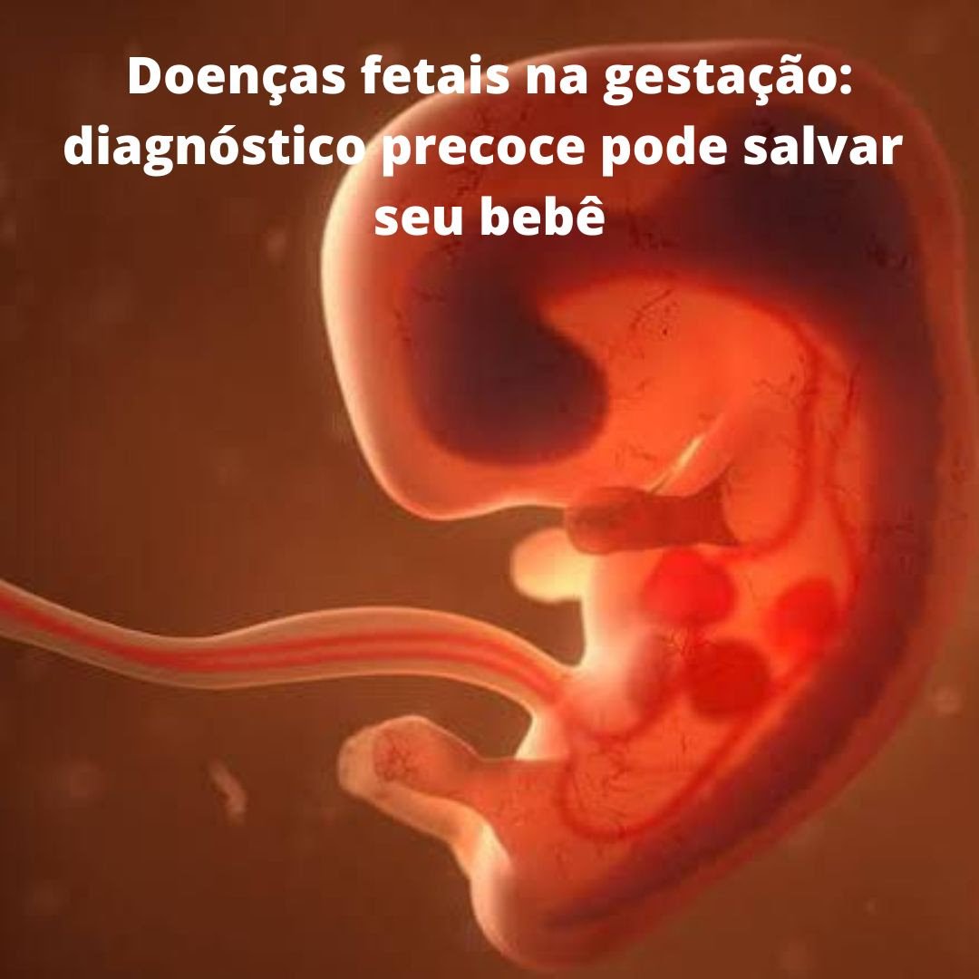 Doenças fetais na gestação: diagnóstico precoce pode salvar seu bebê