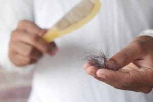 Alopecia: descubra sete sinais que indicam o aparecimento da doença