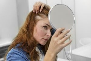 Calvície Feminina: um dos problemas capilares mais frequentes em mulheres